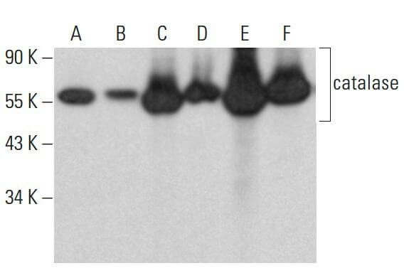 catalase Antibody (H-9) | SCBT - Santa Cruz Biotechnology