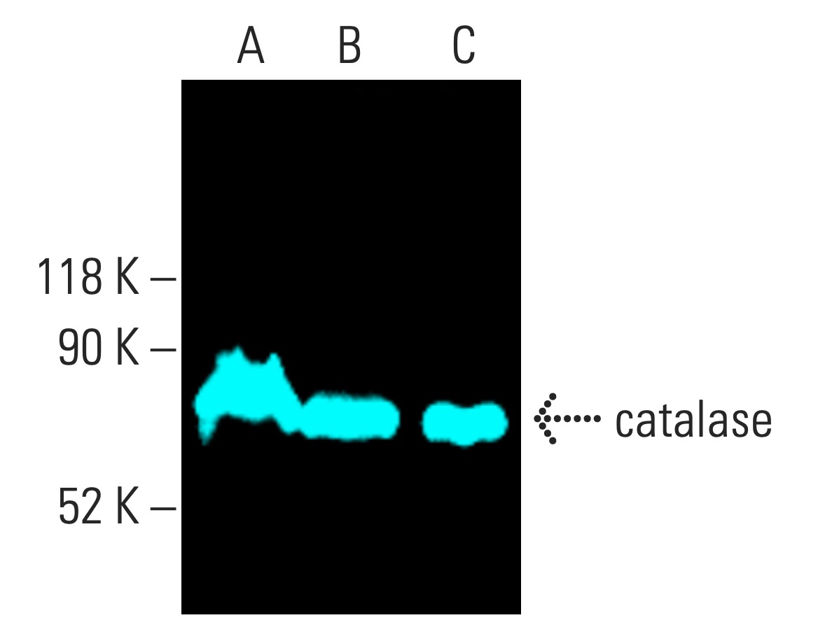 catalase Antibody (H-9) | SCBT - Santa Cruz Biotechnology