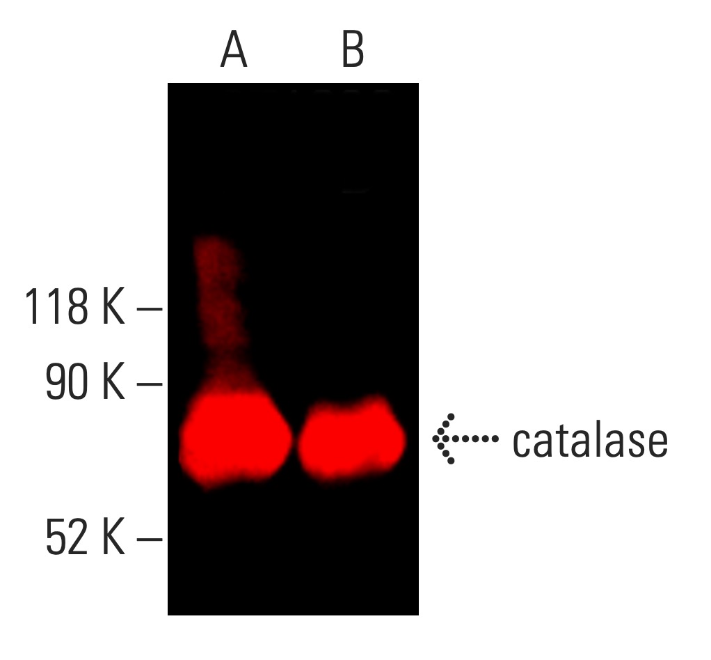 catalase Antibody (H-9) | SCBT - Santa Cruz Biotechnology