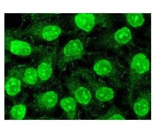 cathepsin B Antibody (H-5) | SCBT - Santa Cruz Biotechnology cathepsin B Antibody (H-5) | SCBT - Santa Cruz Biotechnology
