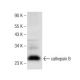 western blotting image from recommended cathepsin B (H-5) monoclonal antibody replacement. Image 142600