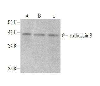 cathepsin B Antibody (H-5) - Western Blotting - Image 353347SAM Transcription Activation: SAM system utilizing dCas9-VP64, MS2-P65-HSF1, and sgRNA for precise gene transcription activation.