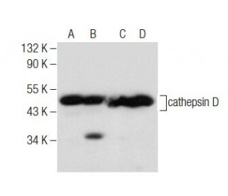 western blotting image from recommended cathepsin D (D-7) monoclonal antibody replacement. Image 283620