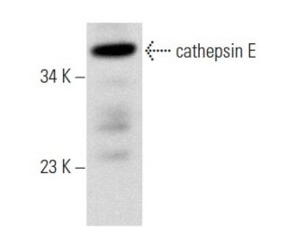 western blotting image from recommended cathepsin E (D-8) monoclonal antibody replacement. Image 358023