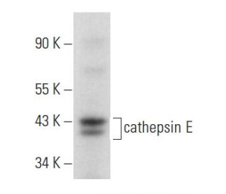 cathepsin E Antibody (E-8) - Western Blotting - Image 358026 