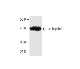 cathepsin H Antibody (5) - Western Blotting - Image 136754