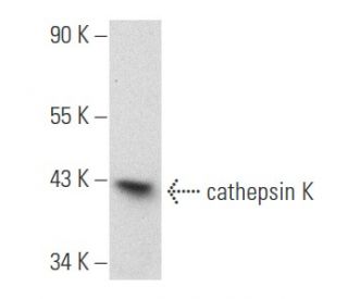 cathepsin K Antibody (E-7) - Western Blotting - Image 354808