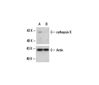 cathepsin K siRNA (m): sc-29937. Western blot analysis of cathepsin K expression in non-transfected control (A) and cathep 