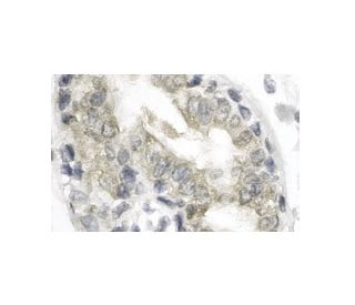 immunohistochemistry image from recommended cathepsin L (33/2) monoclonal antibody replacement. Image 12100