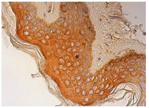 cathepsin-l-antibody-e-5- cathepsin-l-antibody-e-5-
