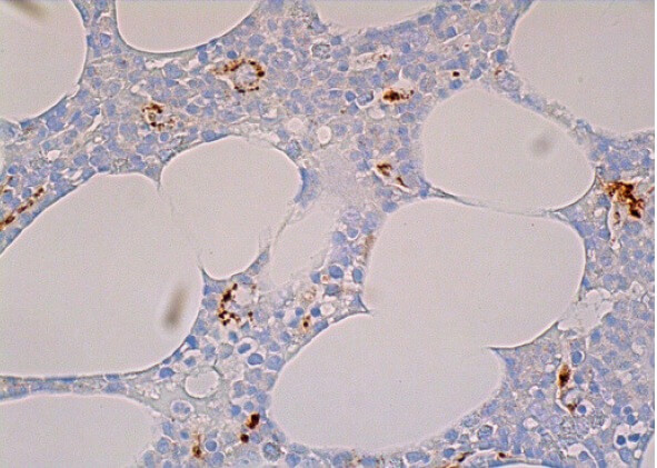 cathepsin S Antibody (E-3) | SCBT - Santa Cruz Biotechnology