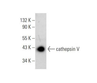 cathepsin V Antibody (CV55-3G11) - Western Blotting - Image 11774