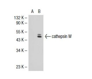 cathepsin W Antibody (6D238) - Western Blotting - Image 35175