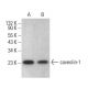 caveolin-1 Antibody (4H312) - Western Blotting - Image 377752 
