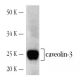 western blotting image from recommended caveolin-3 (A-3) monoclonal antibody replacement. Image 3178