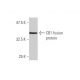 CB1/Cannabinoid Receptor 1/CNR1 Antibody (2F9) - Western Blotting - Image 348457