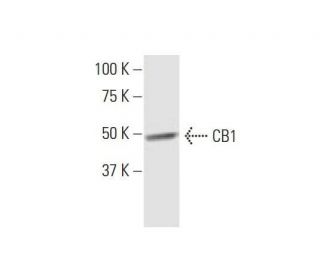 CB1/Cannabinoid Receptor 1/CNR1 Antibody (2F9) - Western Blotting - Image 352105 