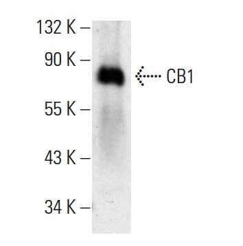 CB1/Cannabinoid Receptor 1/CNR1 Antibody (C-11) | SCBT