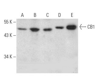 western blotting image from recommended CB1/Cannabinoid Receptor 1/CNR1 (C-11) monoclonal antibody replacement. Image 389152