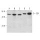 Este anticuerpo policlonal ha dejado de fabricarse. Consulta nuestro anticuerpo monoclonal recomendado <a href="cb1-antibody-c-11">CB1/Cannabinoid Receptor 1/CNR1 (C-11)</a> (se muestran datos de muestra). western blotting image from recommended CB1/Cannabinoid Receptor 1/CNR1 (C-11) monoclonal antibody replacement. Image 389152