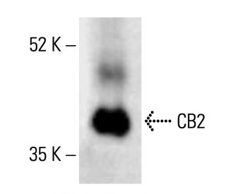 CB2/Cannabinoid Receptor 2/CNR2 Antibody (B-6) - Western Blotting - Image 411989
