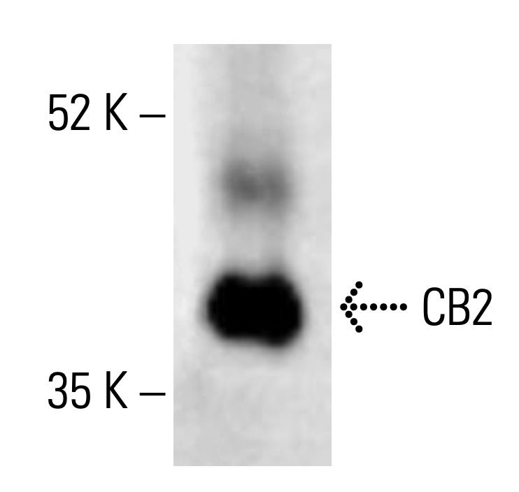 CB2/Cannabinoid Receptor 2/CNR2抗体 (B-6) | SCBT - Santa Cruz Biotechnology