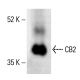 CB2/Cannabinoid Receptor 2/CNR2 Antibody (B-6) - Western Blotting - Image 411989