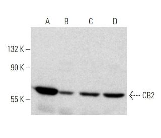 western blotting image from recommended CB2/Cannabinoid Receptor 2/CNR2 (3C7) monoclonal antibody replacement. Image 368036