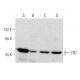 western blotting image from recommended CB2/Cannabinoid Receptor 2/CNR2 (3C7) monoclonal antibody replacement. Image 368036