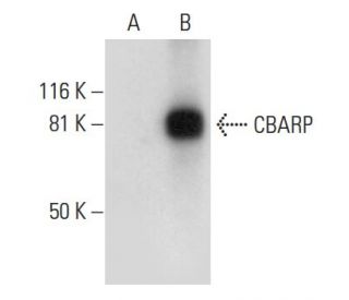 CBARP Antibody (A-11) - Western Blotting - Image 299170 