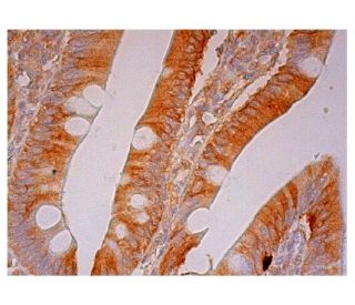 immunohistochemistry image from recommended Cbl-3 (F-2) monoclonal antibody replacement. Image 302389