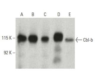 western blotting image from recommended Cbl-b (G-1) monoclonal antibody replacement. Image 397521