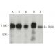 western blotting image from recommended Cbl-b (G-1) monoclonal antibody replacement. Image 397521