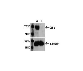 Cbl-b siRNA (h): sc-29950. Western blot analysis of Cbl-b expression in non-transfected control (A) and Cbl-b siRNA transf 