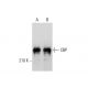 This polyclonal antibody has been discontinued. See our recommended <a href="cbp-antibody-c-1">CBP/KAT3A/CREBBP (C-1)</a> monoclonal antibody (sample data shown). western blotting image from recommended CBP/KAT3A/CREBBP (C-1) monoclonal antibody replacement. Image 136668
