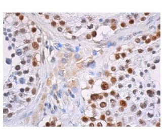 CBP/KAT3A/CREBBP Antibody (C-1) | SCBT - Santa Cruz