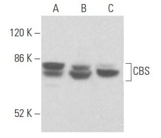 CBS Antibody (A-2) - Western Blotting - Image 355140 