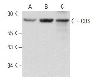 CBS Antibody (A-3) - Western Blotting - Image 354907 