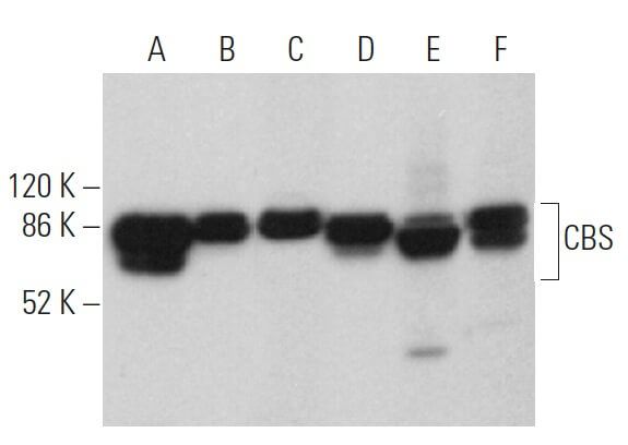 CBS Antibody B 4 SCBT Santa Cruz Biotechnology