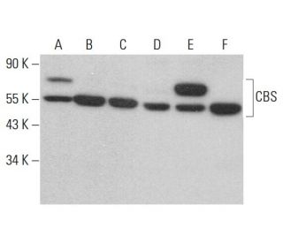 CBS Antibody (G-1) - Western Blotting - Image 378036 