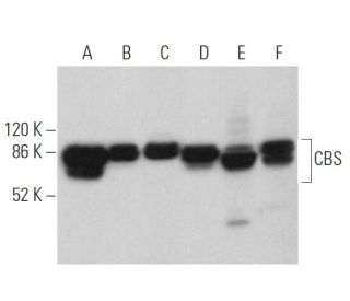 western blotting image from recommended CBS (B-4) monoclonal antibody replacement. Image 361058