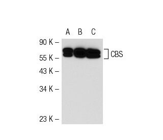 CBS Antibody (B-4) - Western Blotting - Image 55634 