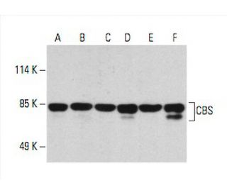 CBS Antibody (B-4) - Western Blotting - Image 394346