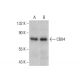 western blotting image from recommended CBX4 (6C5G3) monoclonal antibody replacement. Image 384257