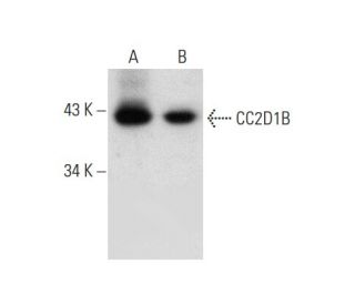 CC2D1B Antibody (E-12) - Western Blotting - Image 136246 