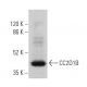 CC2D1B Antibody (E-12) - Western Blotting - Image 366930