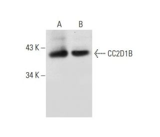 CC2D1B Antibody (F-5) - Western Blotting - Image 136245 