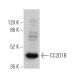CC2D1B Antibody (F-5) - Western Blotting - Image 366931 