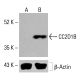 CC2D1B Antibody (F-5) - Western Blotting - Image 414112