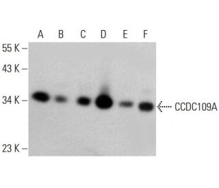 CCDC109A Antibody (E-9) - Western Blotting - Image 381015The Double Nickase Plasmid features a U6 promoter for sgRNA expression, a 20 nt targeting sequence, and a gRNA scaffold to guide Cas9n. It includes a CBh promoter for Cas9n (D10A) and puromycin resistance, GFP for transfection verification, and nuclear localization signals (NLS). The 2A peptide allows co-expression of Cas9n and Puro from a single promoter, enabling precise genome editing with reduced off-target effects.